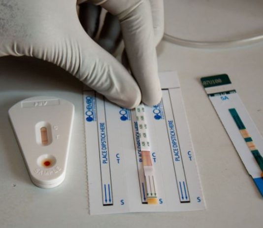 New HIV drug will offer these benefits