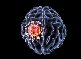 This new drug can halt spread of brain cancer