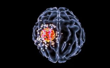 This new drug can halt spread of brain cancer