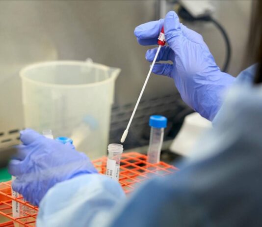 Coronavirus Pandemic: US institution, IIT Madras receive ‘Ignition Grants’ Award for COVID-19 diagnostic device