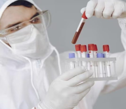 7 crore people under 40 to be screened for sickle cell disease by 2025-26 across 17 states: ICMR